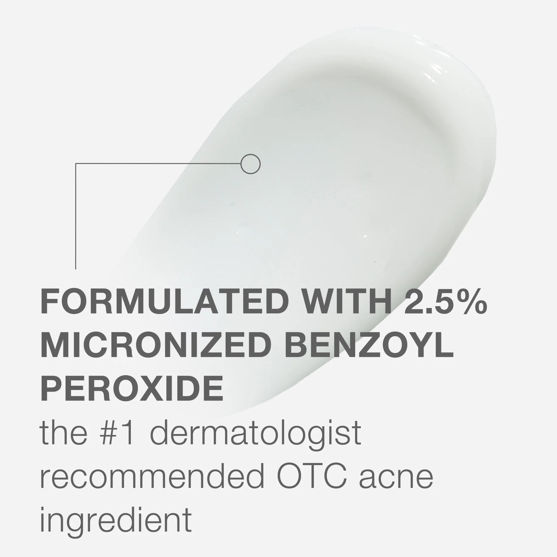 (2 Pack)  Stubborn Acne AM Treatment with Benzoyl Peroxide, 2.0 Oz